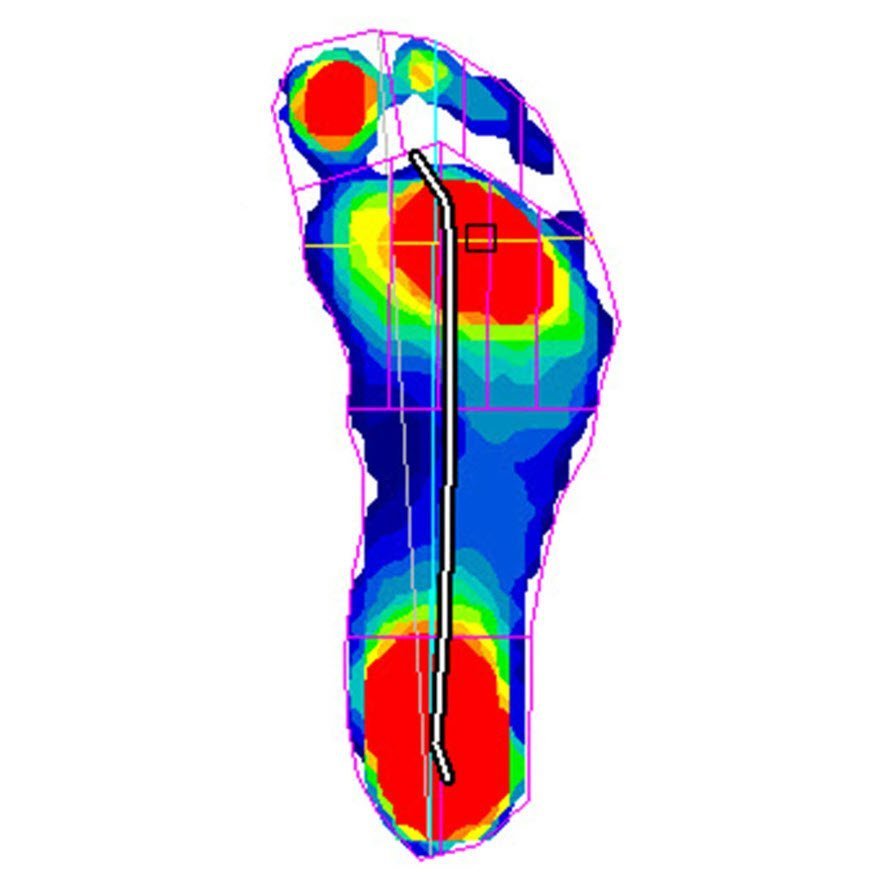 pressure mapping