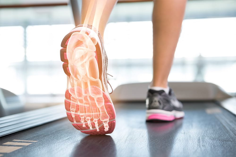 The Big Blister Misconception: What's Moving?