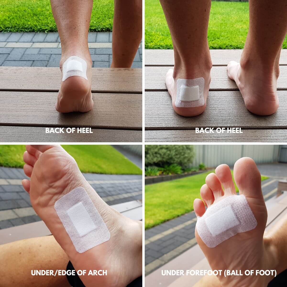 Smith & Nephew Primapore Island Dressings Dressings - Blister Prevention