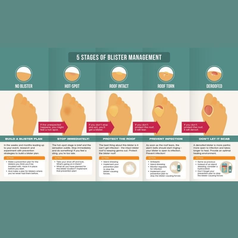 BlisterPod Blister Kits Blister Kit - Blister Prevention